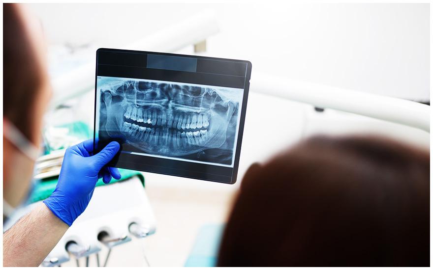 stomatolog przeglądający zdjęcie rentgenowskie